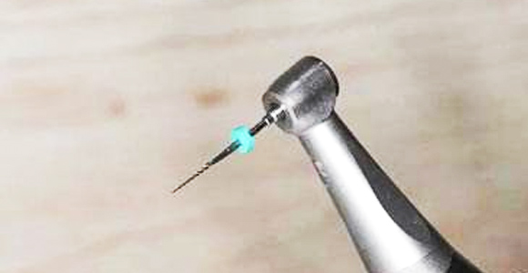 精細切割，極大程度保留牙神經，根管治療成功率極高