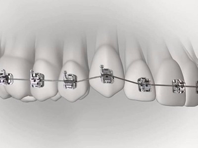 承德市哪家口腔醫(yī)院口腔正畸做得好？惟德口腔醫(yī)院來告訴您