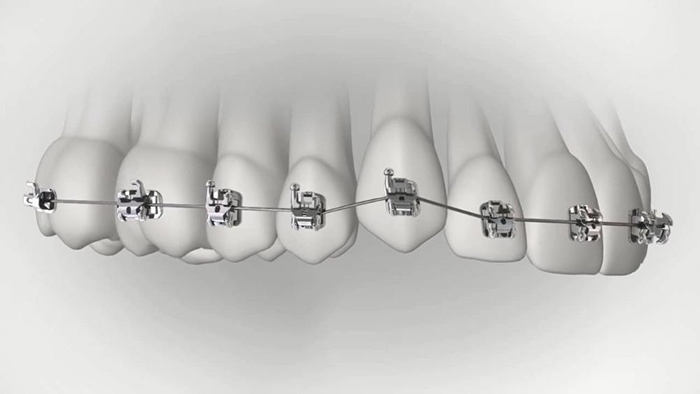 承德市哪家口腔醫(yī)院口腔正畸做得好？惟德口腔醫(yī)院來(lái)告訴您