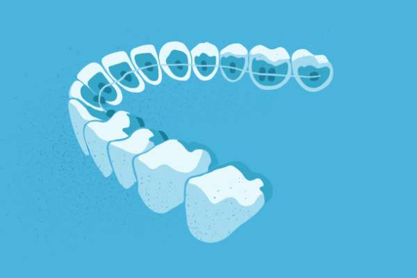 惟德口腔醫(yī)院口腔正畸好不好？